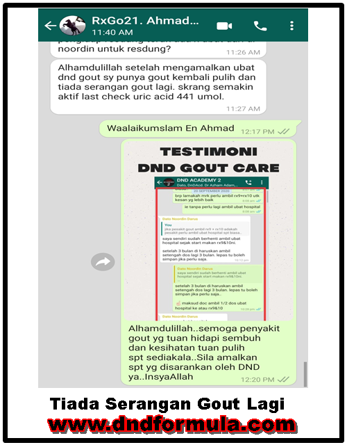 gout-tiada serangan gout lagi